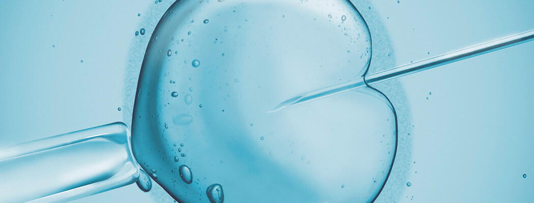 Injeção Intracitoplasmática de Esperma (ICSI): o que é?