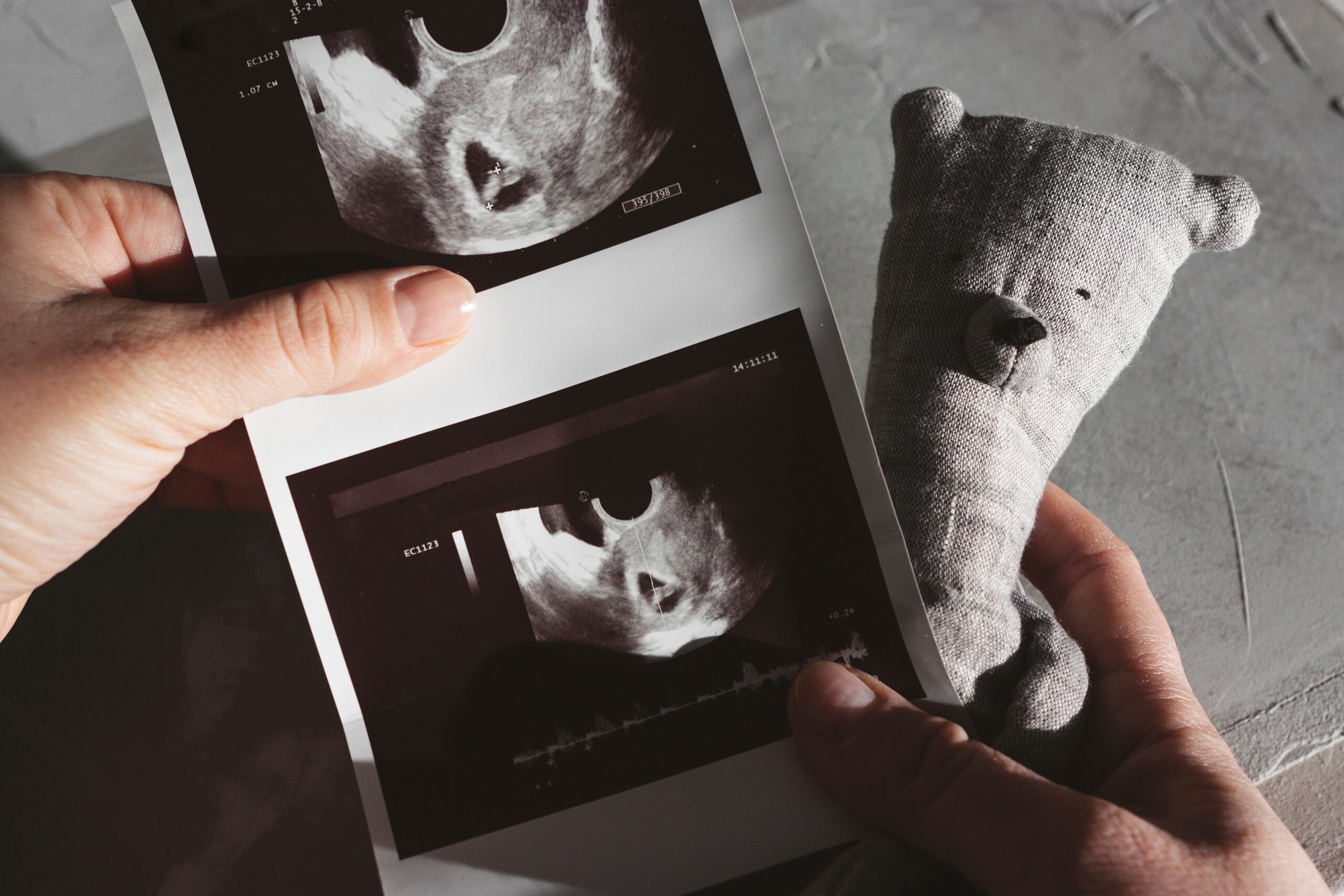 Várias causas podem estar por trás do aborto espontâneo
