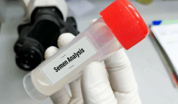 Veja quais infecções causam alterações no sêmen e provocam infertilidade
