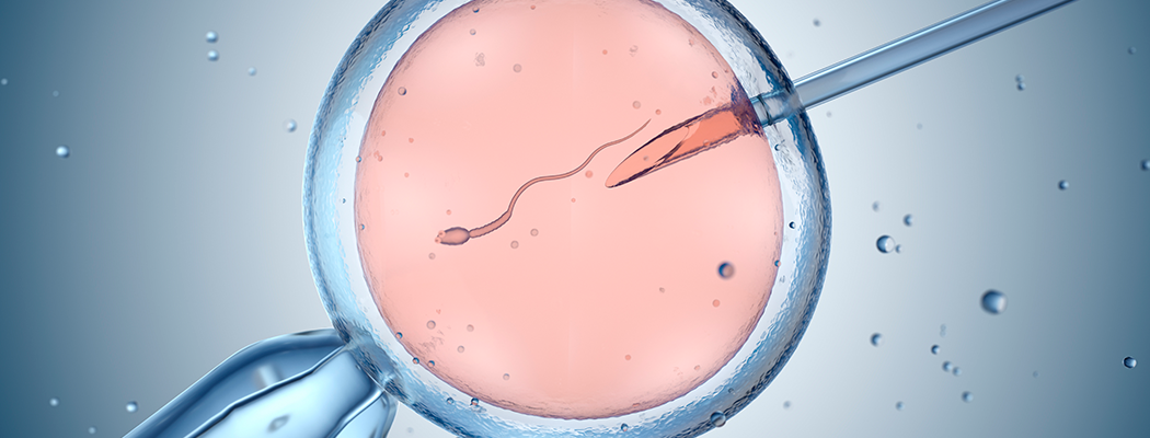 Inseminação intrauterina: quando escolher?