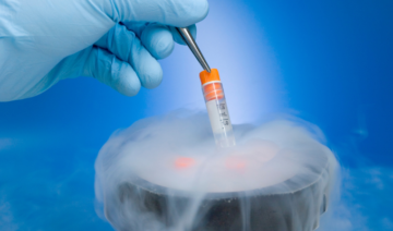 Congelar óvulos é sinal de medo de engravidar? Entenda o que está por trás dessa escolha